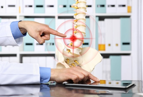 compression fracture