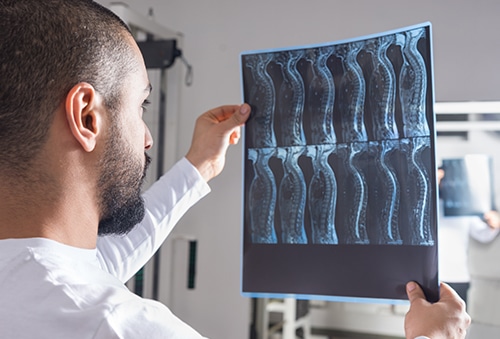 myelopathy