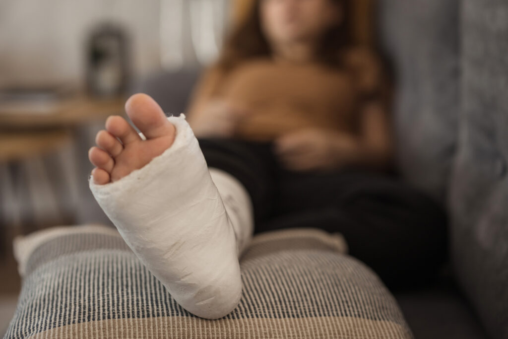 Person with fractured ankle wearing cast