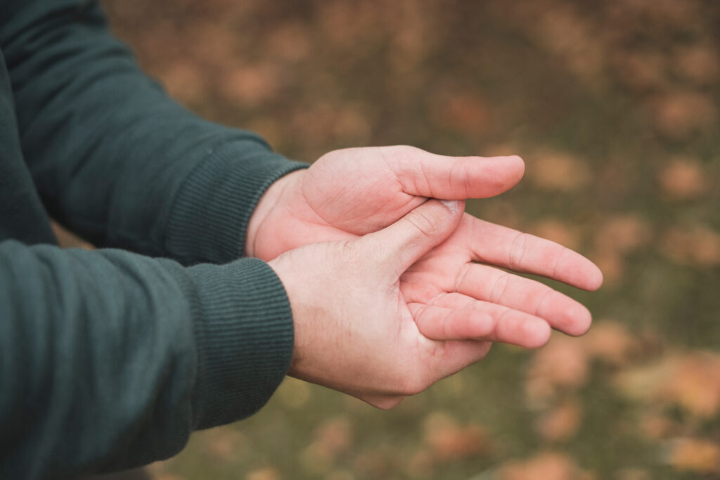 man scratching his hand