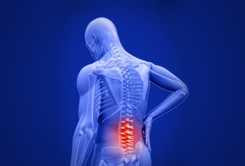 post laminectomy syndrome img