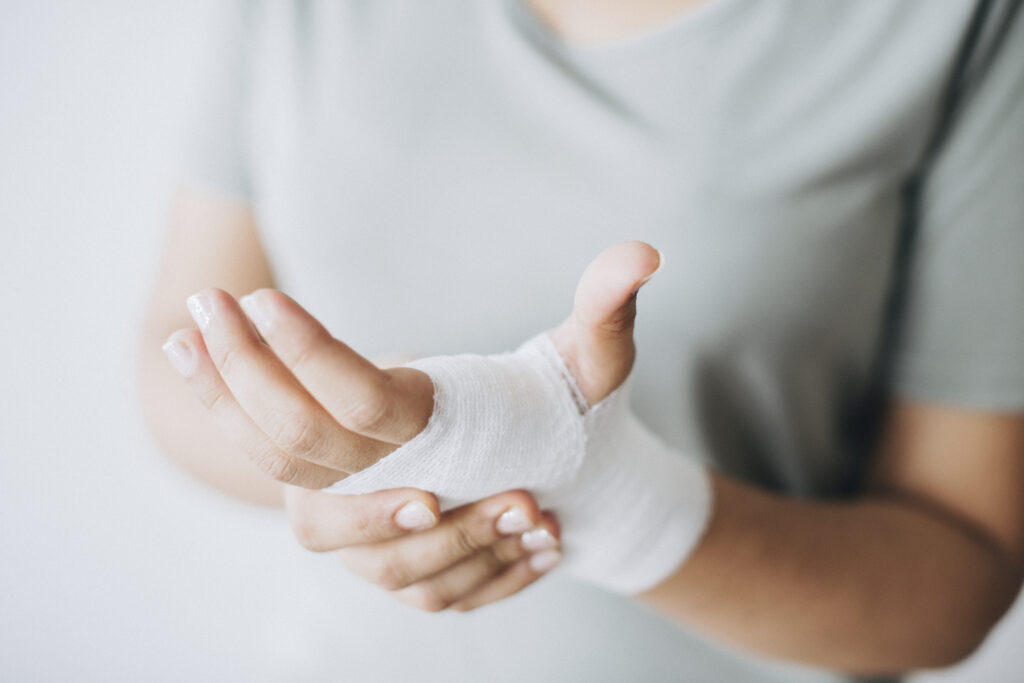 woman with gauze bandage wrapped around her hand
