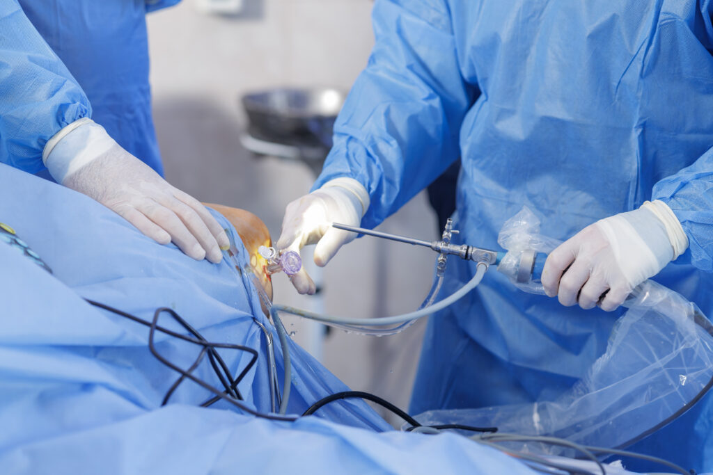Orthopedic surgeons performing knee arthroscopy in operating room