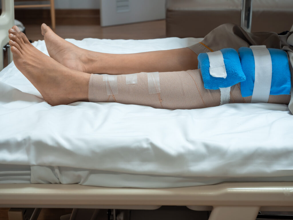 Patient lying in hospital bed with ice and compression wrap on knee